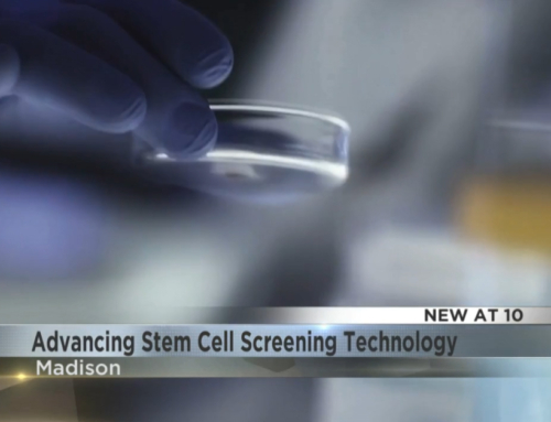 New technology developed at UW-Madison aims to detect developmental disorders before birth